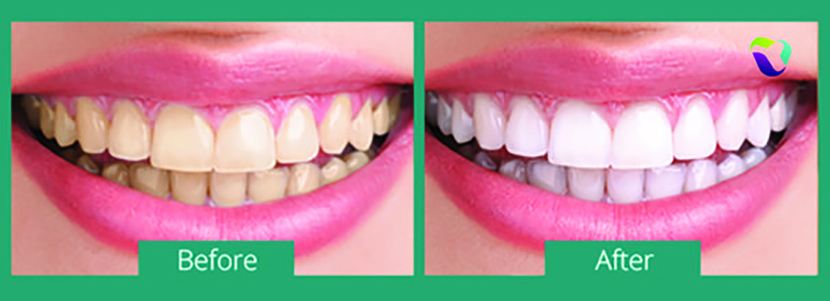 Home - bellevue-dentist - Dental care, Dentist, Dentistry